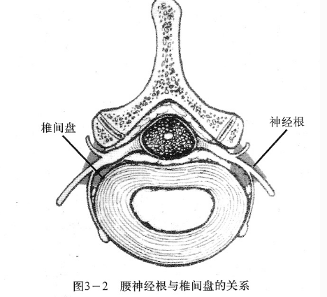 腰椎間盤(pán)突出癥狀表現(xiàn) (64)