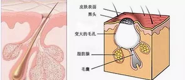 为什么会长痘，祛痘印去痘痘最全的方法