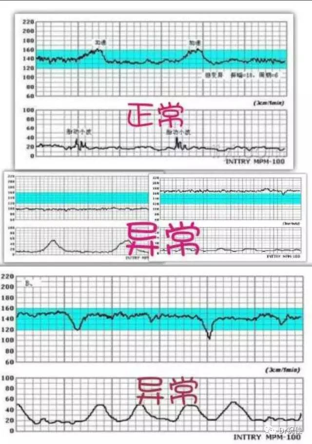 孕期胎儿监测三大法宝