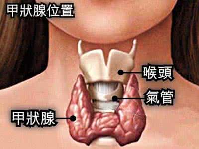 甲状腺癌外科治疗要点是什么?