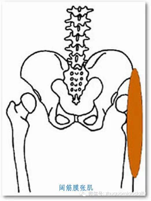 髋,股,膝外侧疼痛——阔筋膜张肌髂胫束损伤