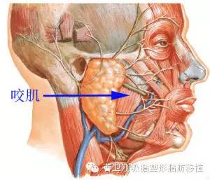 怎么判断面部配胖是由于咬肌肥大导致的呢?