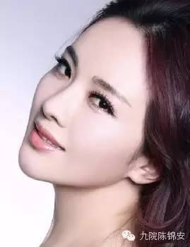 双生痣的图片女孩 ooYBAFm6ZNqAHditAAAmmDkn3ZI55.jpeg