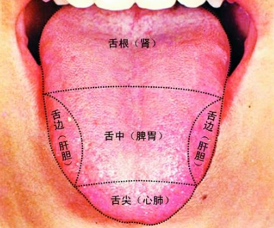 胃炎的症状舌头图片 (5)