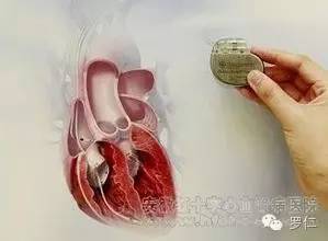 安置永久性心脏起搏器注意什么?