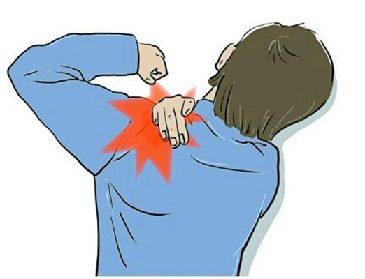肩周炎疼痛部位图片 (8)