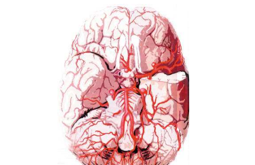 脑血管疾病 (7)