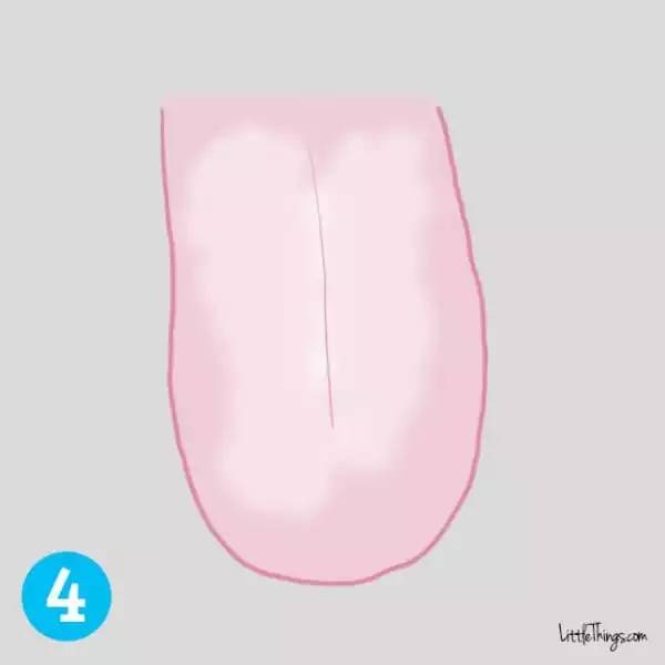 舌苔发白,还有一点点口腔溃疡,是什么原因