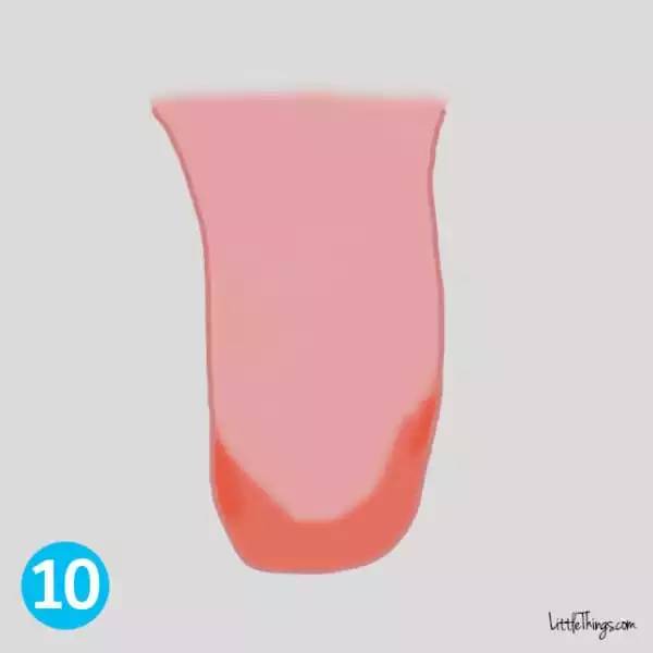 10号舌头:舌头是粉红色,但前端边缘较红