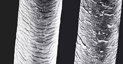 脱发、掉头发?从头发也能够看出你的身体疾病