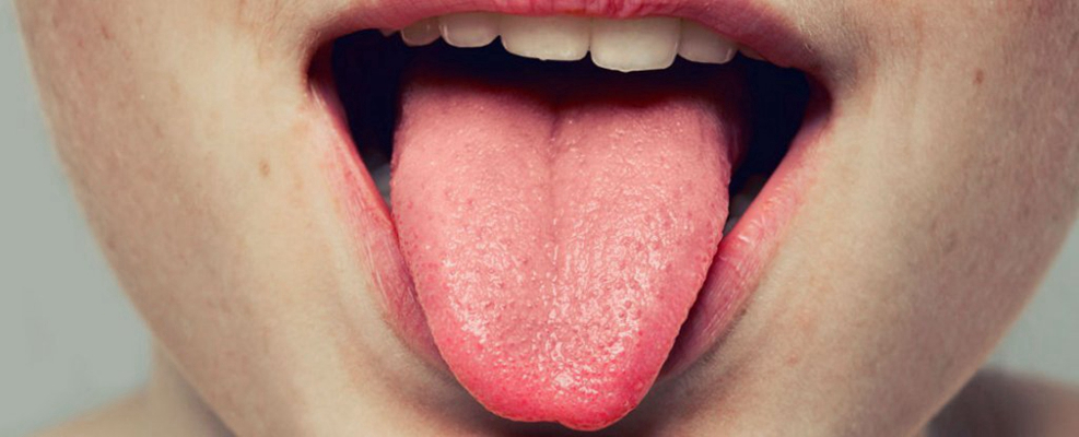 舌头发紫图片(43)