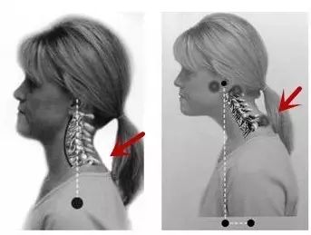 你的颈椎还好吗?