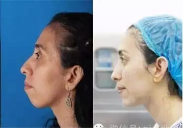 好看的下巴是啥样?