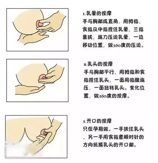 母乳喂养中,乳头皲裂怎么办?如何缓解?