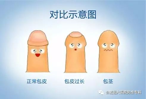 包皮包茎过长有哪些危害?