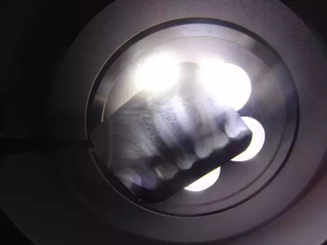 乳牙不用治、牙齿一痛就杀神经?这些你认为对