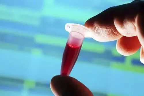 出现这些病症表现,要高度怀疑再障