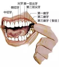 智齿拔或不拔?你还在纠结吗?
