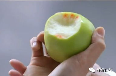 冬季牙龈出血不可忽视