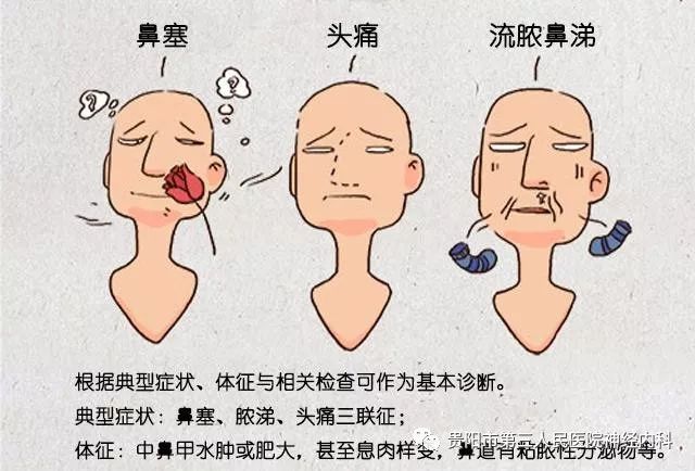 感冒后鼻塞脓涕可能是得了鼻窦炎