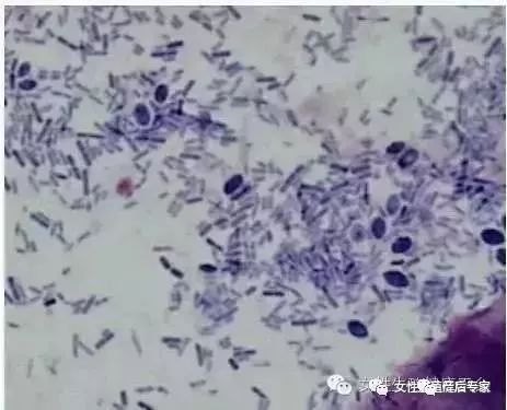 阴道滴虫真的是"虫"吗?