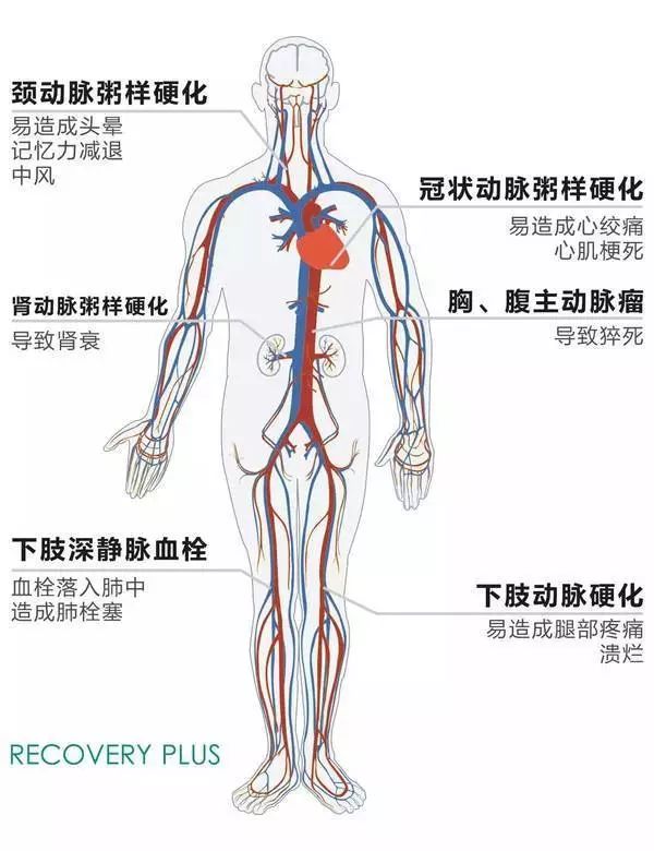 保护血管,到底应该怎么做?