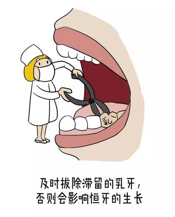 6,牙早失时使用间隙保持器