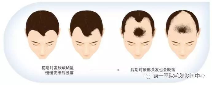 生长期的头发会不断的生长,每日生长速度约为0.27-0.