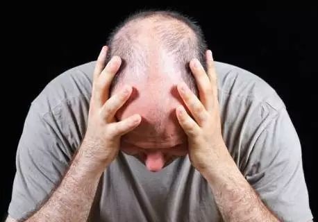 毛囊萎缩和毛囊闭合有什么区别?