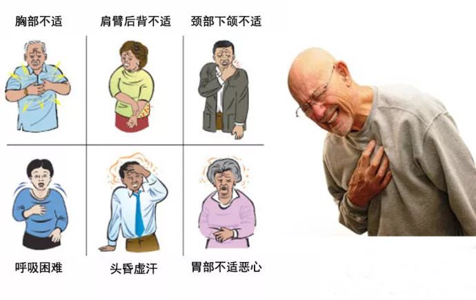 也可位于双肩,手臂,后背,牙齿,下颌和颈部; 胸痛频繁; 上腹持续性疼痛