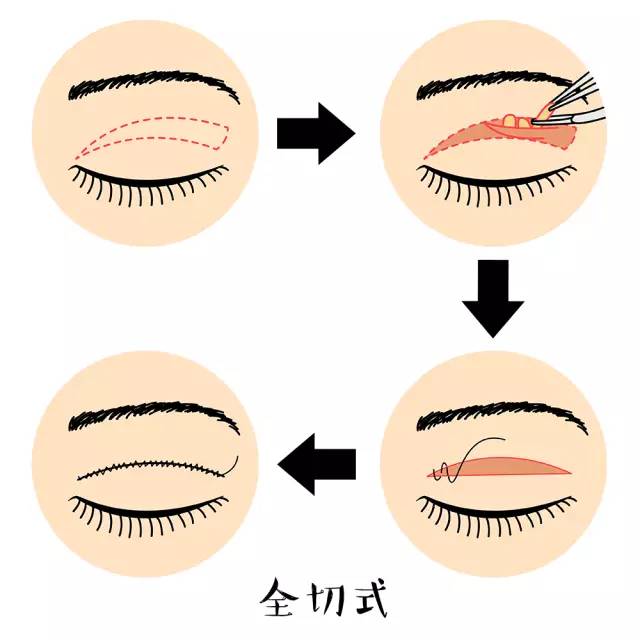 ˫Ƥ״ôѡ