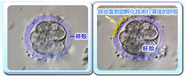 jpg 辅助孵化.jpg
