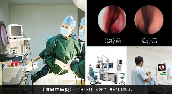 【过敏性鼻炎】“HIFU飞波”技术.jpg