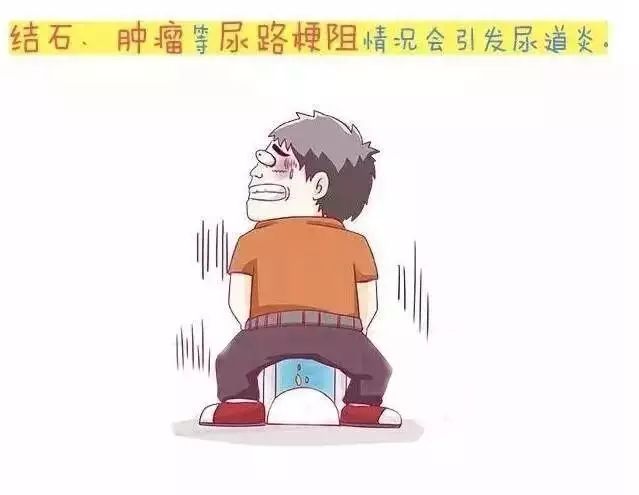 怎么治疗尿道炎?