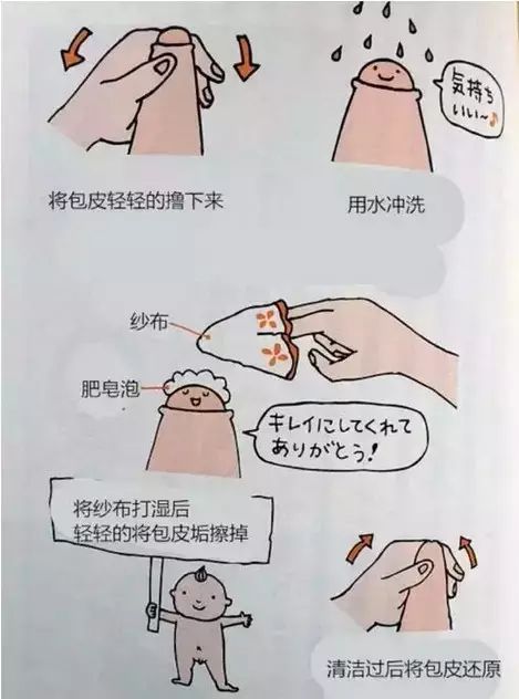 男孩包皮过长要不要割?