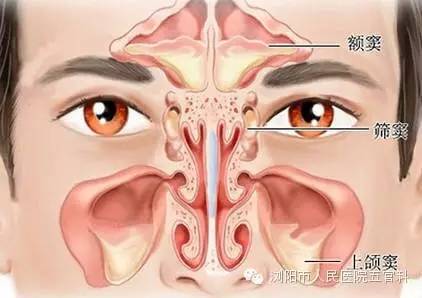 2)其他手术  上颌窦鼻内开窗术,上颌窦根治术,鼻内筛窦切除术,鼻外
