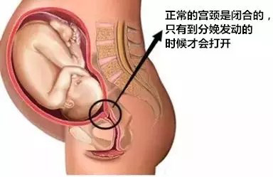正常妊娠.jpg