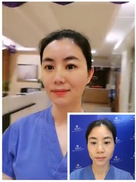 丽丽对比照.jpg