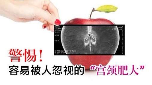 宫颈肥大有哪些典型症状?