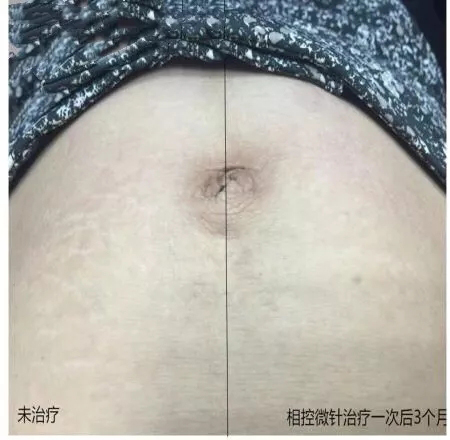 对比图.jpg
