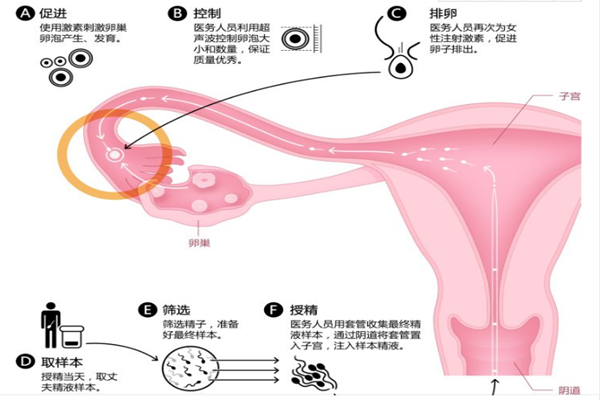 人工授精_副本.png