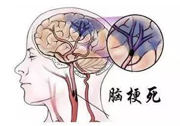 u=2015183510,1384229208&fm=26&gp=0.jpg