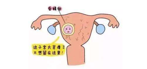jpg 子宫内膜薄.jpg