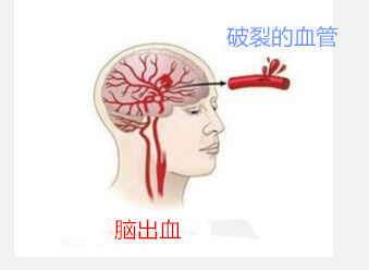 u=1098212759,3391303148&fm=26&gp=0.jpg