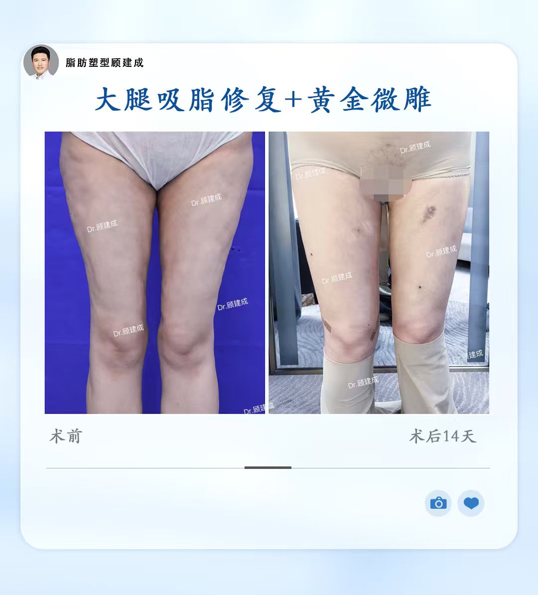 png 图片4.png