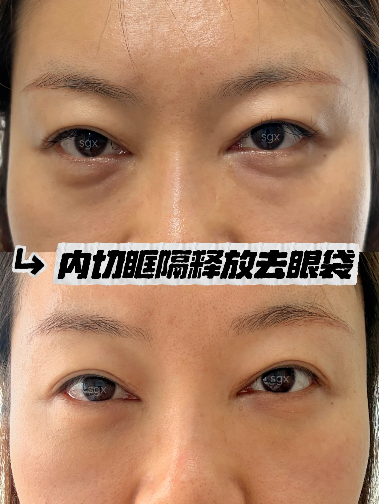png 图片1.png