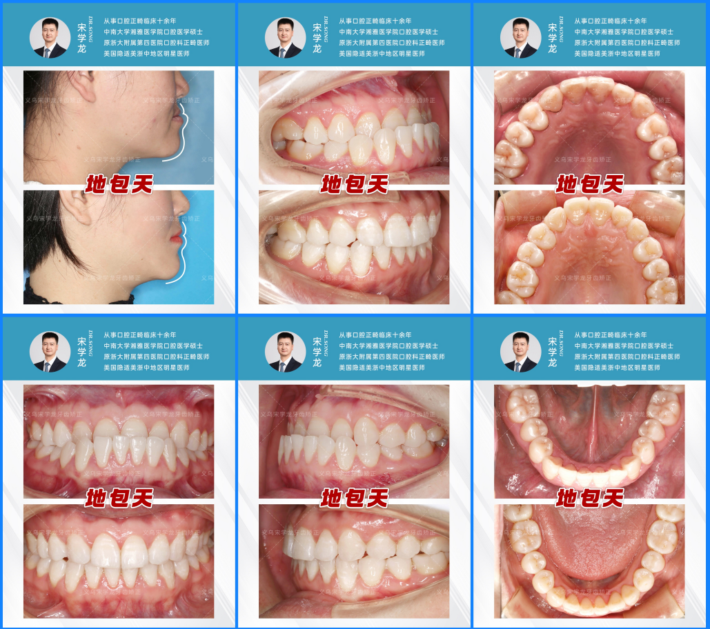 png 图片7.png