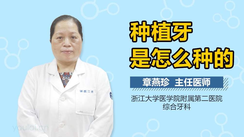 種植牙是怎么種的