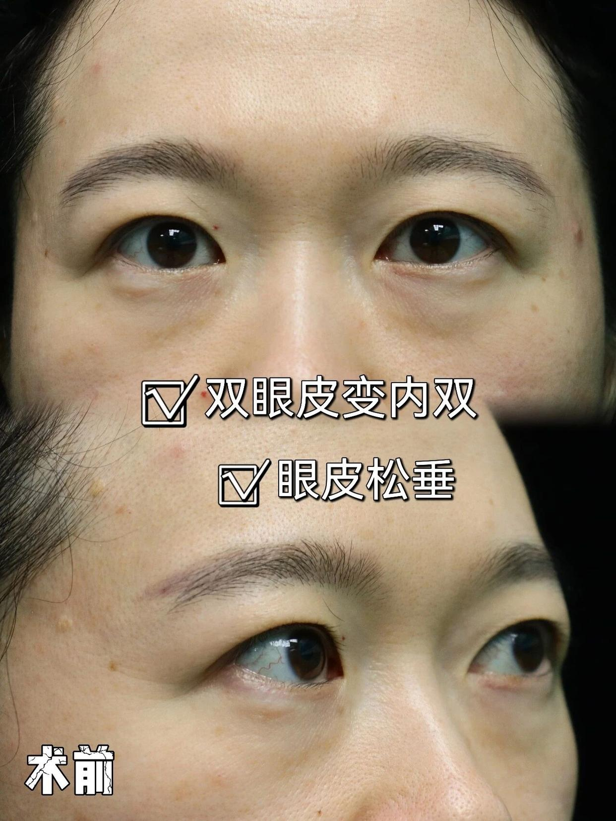 png 图片20.png