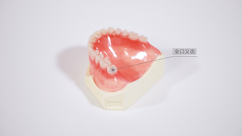 png 可摘全口义齿.png
